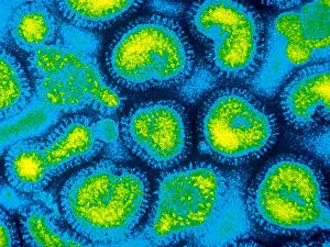 Histopathic Prints: Influenza (TEM)