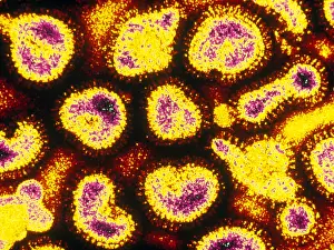 Influenza (TEM)