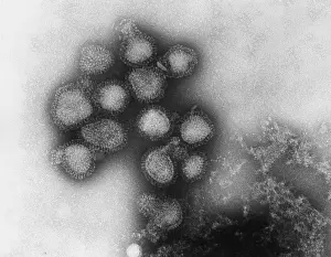 Influenza Prints: Influenza Virus