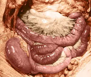 2011 Prints: Intestines