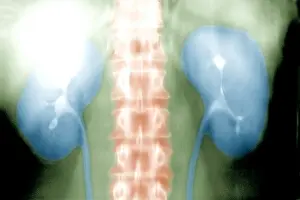 Collecting Prints: Intravenous pyelogram (IVP)
