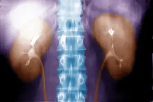 2005 Prints: Intravenous pyelogram of the kidneys