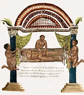 Joint Prints: Joint Dislocation Treatment, 1st Century BC