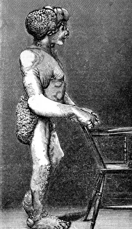 Type Prints: Joseph Merrick, The Elephant Man