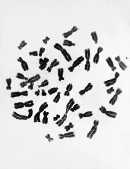 Segment Prints: Karyotype, Normal Female Chromosomes