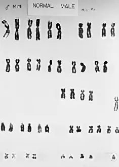 Segment Prints: Karyotype, Normal Male Chromosomes