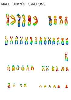 Segment Prints: Karyotype, Down Syndrome