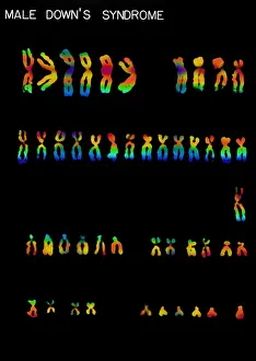 Mutation Prints: Karyotype, Down Syndrome
