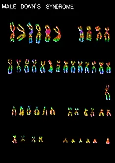 Mutation Prints: Karyotype, Down Syndrome
