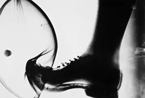 Football Prints: Kicking a Ball, X-ray