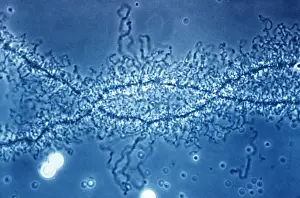 Transmission Prints: Lampbrush Chromosome