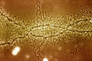 Transmission Prints: Lampbrush Chromosome