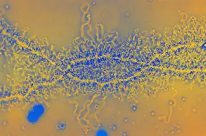 Transmission Prints: Lampbrush Chromosome