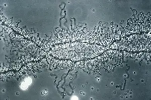 Transmission Prints: Lampbrush chromosome