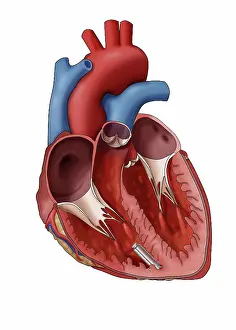 Technology Prints: Leadless Pacemaker, Illustration