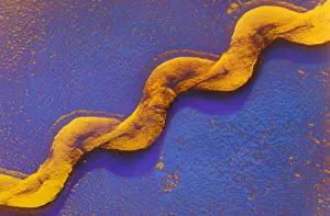 2000 Prints: Leptospira Bacteria, under a microscope (SEM)