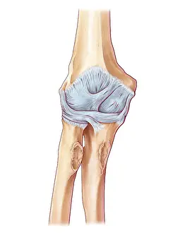 2016 Prints: Ligaments of the Elbow