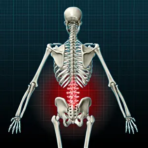 Back Prints: Lower Back Pain, Illustration
