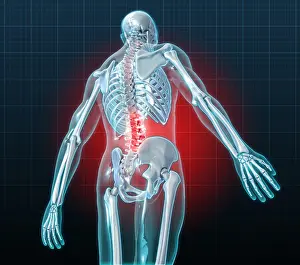 Back Prints: Lower Back Pain, Illustration