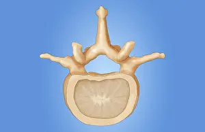 Axial Prints: Lumbar Vertebra
