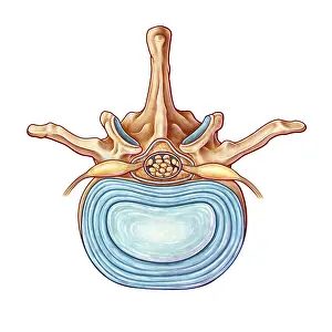 2016 Prints: Lumbar Vertebra and Disk, illustration