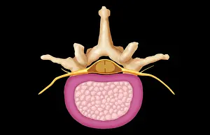 Back Prints: Lumbar Vertebra and Normal Disk