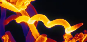 Spirals Prints: Lyme disease bacteria