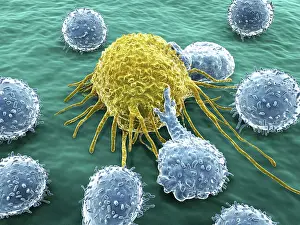 Pathological Prints: Lymphocytes and cancer cell