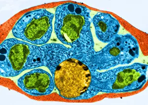 Protist Prints: Malaria, Plasmodium cathemerium, TEM