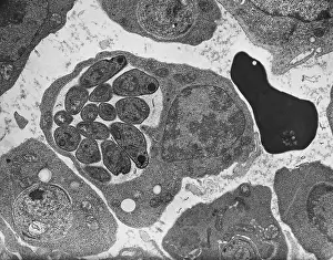 Protist Prints: Malaria, Plasmodium cathemerium, TEM