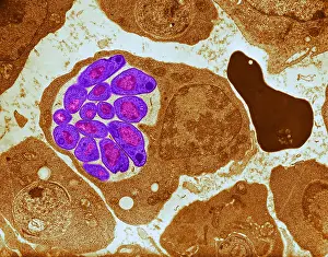Protist Prints: Malaria, Plasmodium cathemerium, TEM