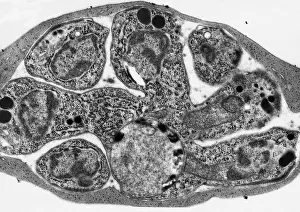 Protist Prints: Malaria, Plasmodium cathemerium, TEM