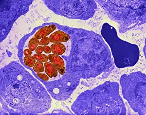 Protist Prints: Malaria, Plasmodium cathemerium, TEM