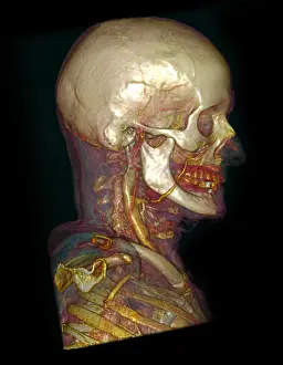 Profile Prints: Male Skull & Arterial System