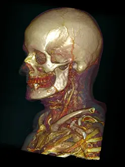 Profile Prints: Male Skull & Arterial System