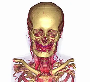 Scan Prints: Male Skull & Arterial System