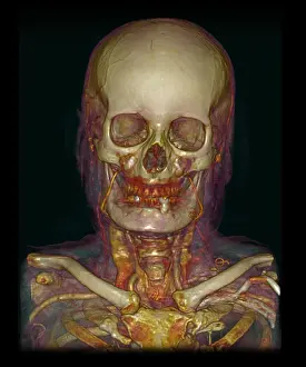 Scan Prints: Male Skull & Arterial System