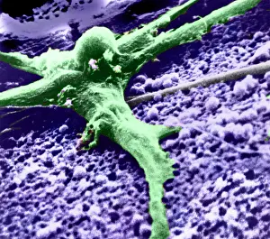 Malignancies Prints: Malignant cancer cell