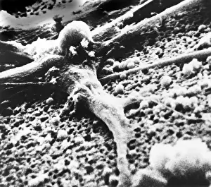 Malignant cancer cell