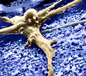 Malignancies Prints: Malignant cancer cell