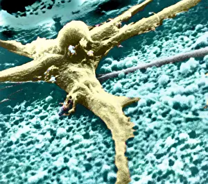 Malignancies Prints: Malignant cancer cell
