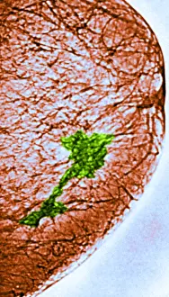 Breasts Prints: Mammogram