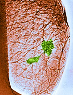 Breasts Prints: Mammogram