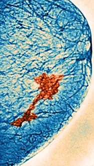 Mammogram