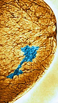 Tissue Prints: Mammogram