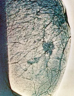 Tissue Prints: Mammogram