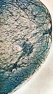 Tissue Prints: Mammogram