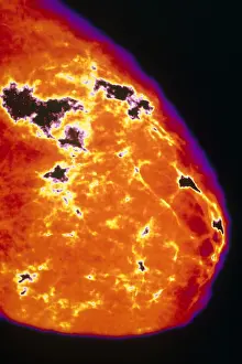 Test Prints: Mammogram