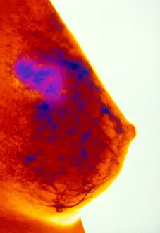Test Prints: Mammogram