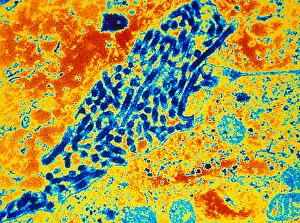 Virus Prints: Marburg Virus (TEM)